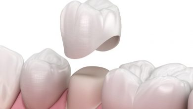how-much-tooth-is-needed-for-a-dental-crown:-understanding-tooth-structure-and-restoration